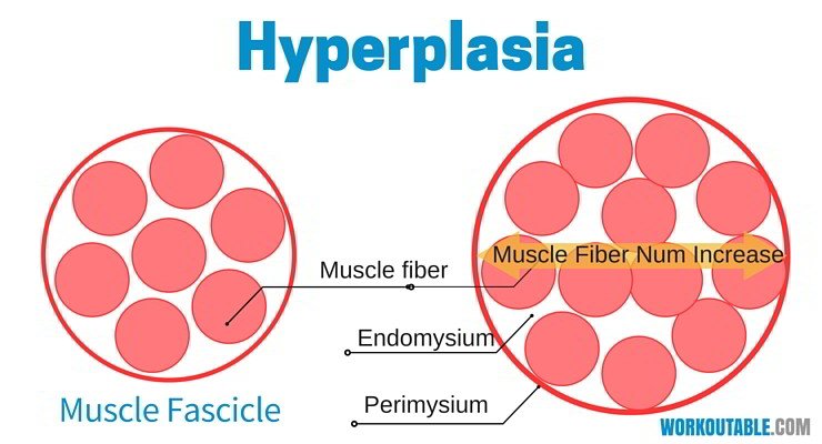 muscle hyperplasia